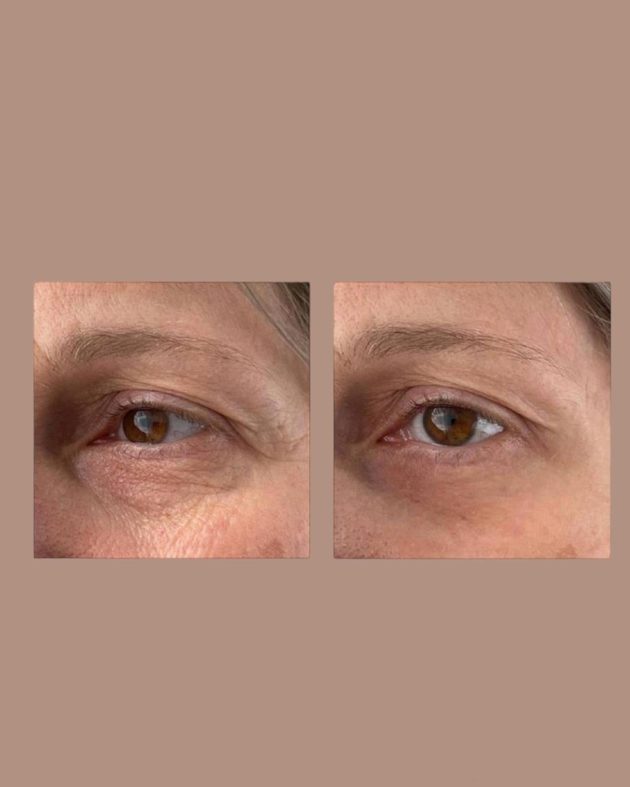 Peptilux Augencreme gegen Tränensäcke/Falten/Augenringe 20ml (LUX001)