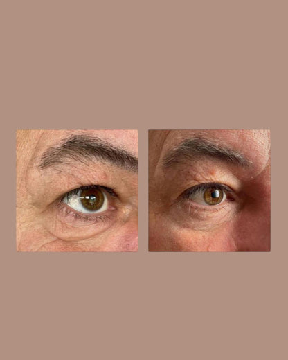 Peptilux Augencreme gegen Tränensäcke/Falten/Augenringe 20ml (LUX001)