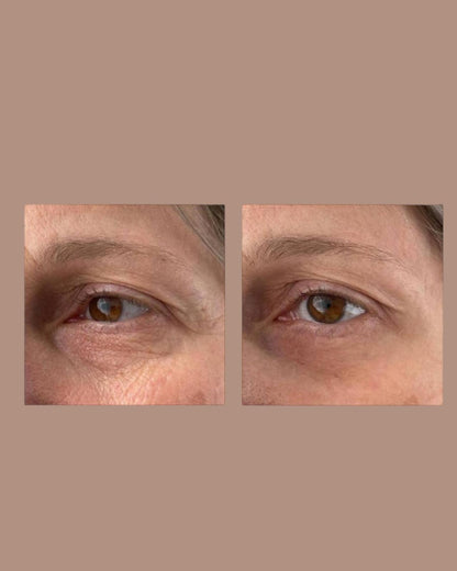 Peptilux Augencreme gegen Tränensäcke/Falten/Augenringe 20ml (LUX001)