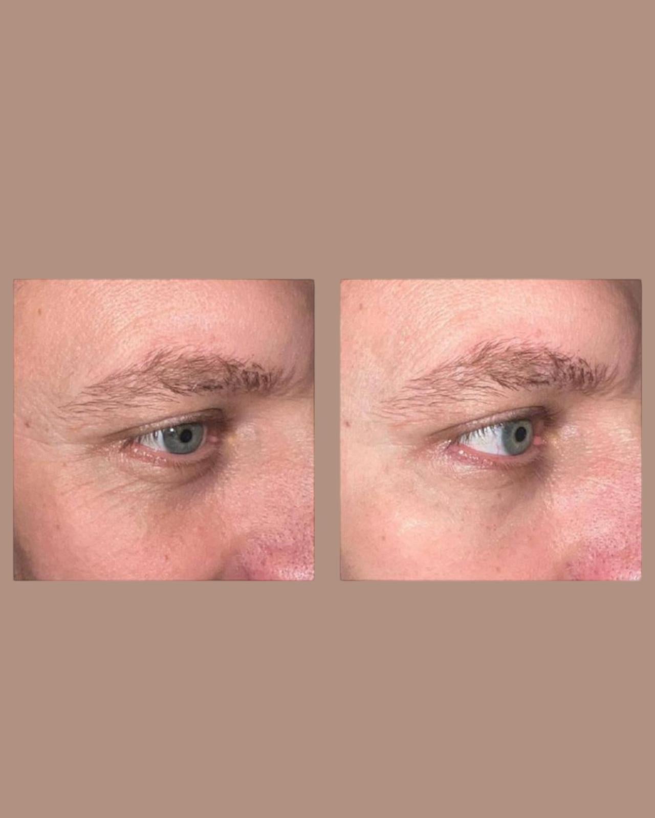 Peptilux Augencreme gegen Tränensäcke/Falten/Augenringe 20ml (LUX001)